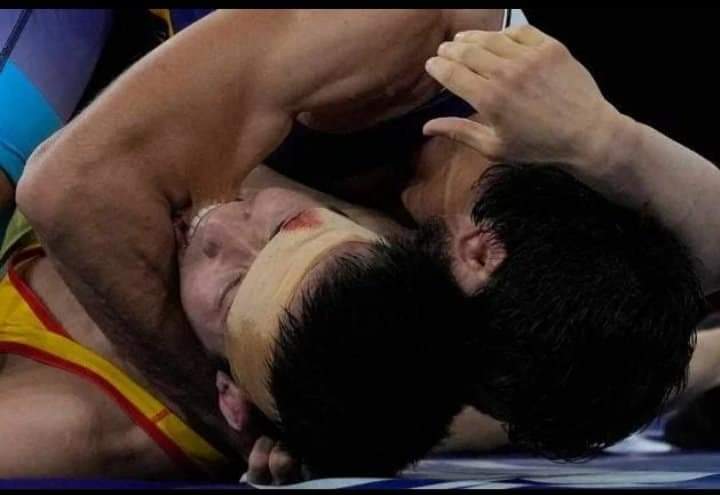 रवि दहिया ने जीत दर्ज की , विपक्षी खिलाड़ी नूरइस्लाम ने काटा दांत , रवि ने फिर भी दिखाया दम 3 WhatsApp Image 2021 08 04 at 9.17.18 PM